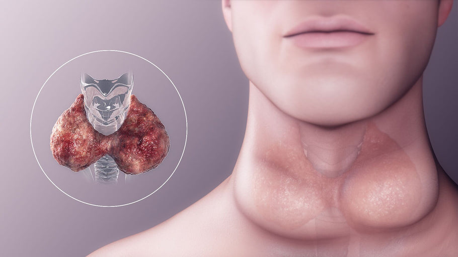 Hypothyroidism: What Is It, And Can It Be Healed Holistically?