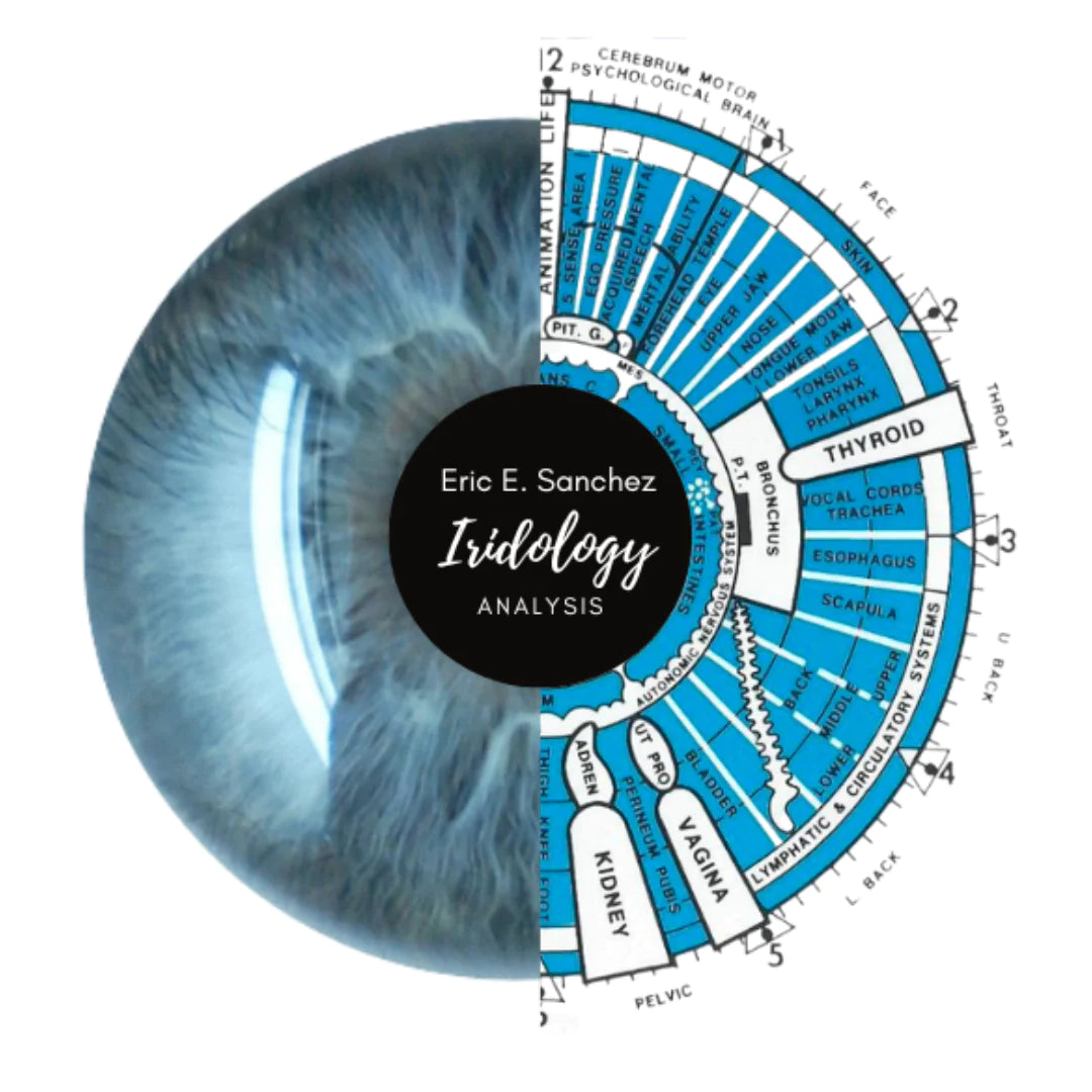 What Is Iridology & What Can You Expect From Your Iridology Report ...