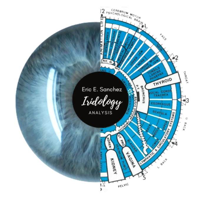 What Is Iridology & What Can You Expect From Your Iridology Report?
